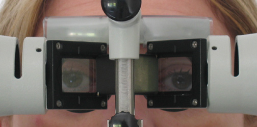 sbisa synoptophore