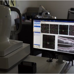 Image oct et oct angiography optovue octa